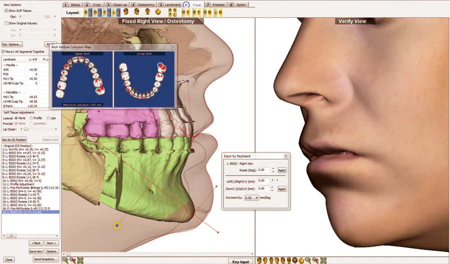 Planejamento Virtual 3D